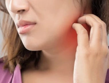 Ένας στους δέκα ανθρώπους παρουσιάζει έκζεμα κάποια στιγμή στην ζωή του